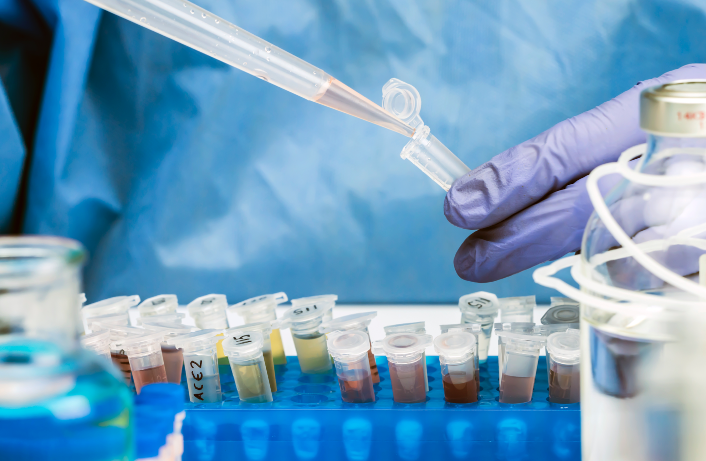 What is wastewater analysis? Siris